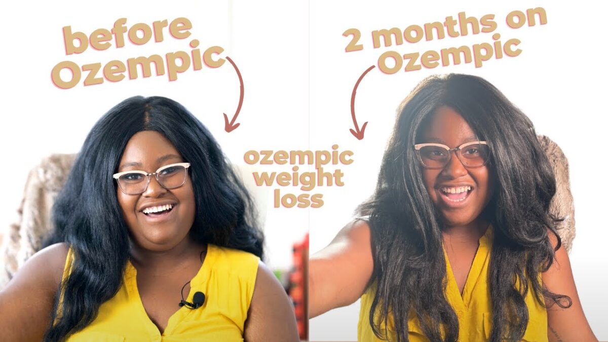 2-months-on-ozempic-weight-loss-before-and-after-side-effects