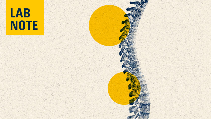 Mental health is an issue for people with spinal cord injury. Chronic pain makes it worse